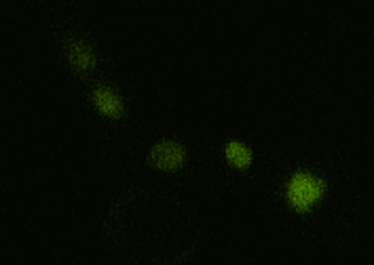 Cells - Spatio Temporal Simulation Cells - Spatio Temporal Simulation